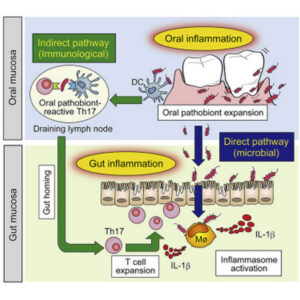 bolesti usne šupljine